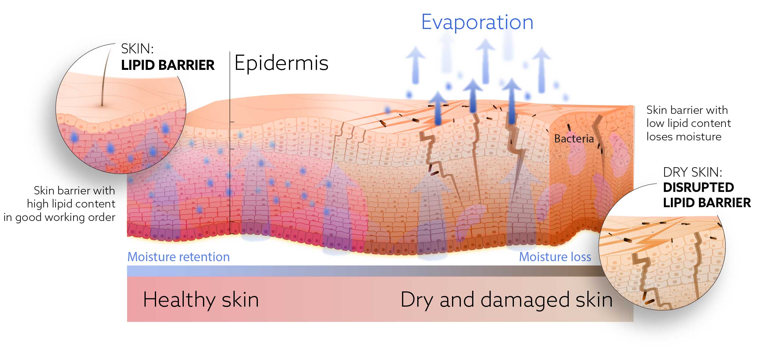 Dry skin hydration krill oil
